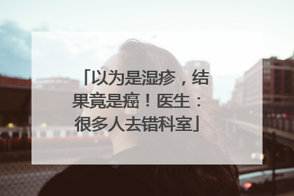 以为是湿疹，结果竟是癌！医生：很多人去错科室
